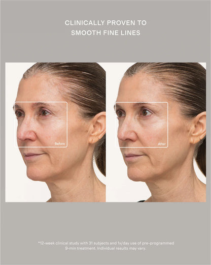 TheraFace Mask by Therabody - One Size / No Color