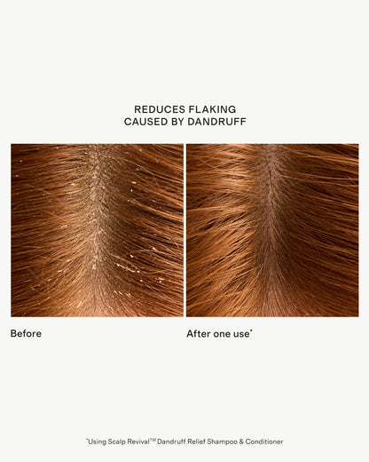 Scalp Revival™ Dandruff Relief Shampoo 8.4oz by Briogeo - One Size / No Color